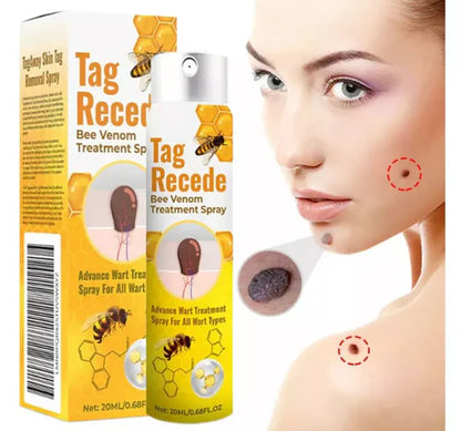 Tratamiento Para la Eliminación de Verrugas🌿 - ¿CANSADO DE TENER VERRUGAS? ¡Obtén TAG RECEDE! 🐝. ✨